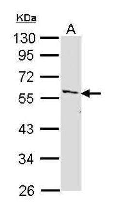 Invitrogen IRAK4 Polyclonal Antibody 100 &mu;L; Unconjugated:Antibodies,