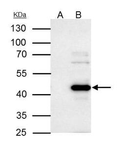 WWOX Polyclonal Antibody:Antibodies, Polyclonal