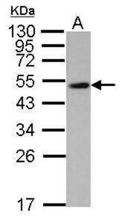 WWOX Polyclonal Antibody:Antibodies, Polyclonal