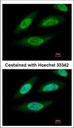 Invitrogen CK2 beta Polyclonal Antibody 100 &mu;L | Buy Online | Invitrogen&trade; | Fisher Scientific