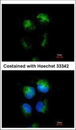 Invitrogen CD99 Polyclonal Antibody 100 &mu;L; Unconjugated:Anticuerpos