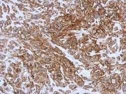 Invitrogen CD99 Polyclonal Antibody 100 &mu;L; Unconjugated:Antibodies,