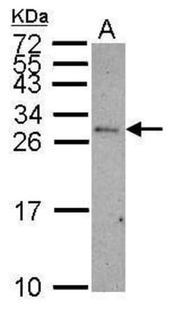 Invitrogen CD99 Polyclonal Antibody 100 &mu;L; Unconjugated:Antibodies,