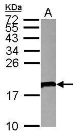 Invitrogen CD179a Polyclonal Antibody 100 &mu;L | Buy Online | Invitrogen&trade; | Fisher Scientific