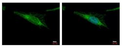 Invitrogen ALDH2 Polyclonal Antibody 100 &mu;L; Unconjugated:Antibodies,