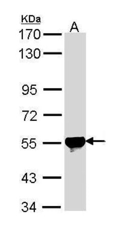 Invitrogen ALDH2 Polyclonal Antibody 100 &mu;L; Unconjugated:Antibodies,
