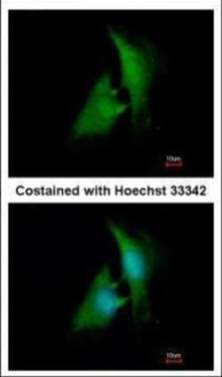 Invitrogen AKR1B1 Polyclonal Antibody 100 &mu;L; Unconjugated:Antibodies,