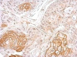 Invitrogen ATP1B1 Polyclonal Antibody 100 μL; Unconjugated:Antibodies,