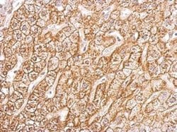 Invitrogen ATP1B1 Polyclonal Antibody 100 μL; Unconjugated:Antibodies,