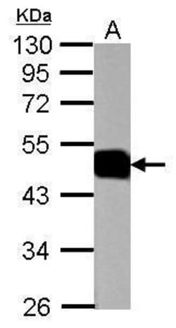 Invitrogen ATP1B1 Polyclonal Antibody 100 μL; Unconjugated:Antibodies,