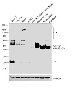 Invitrogen ATP1B1 Polyclonal Antibody 100 μL; Unconjugated:Antibodies,