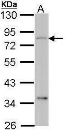 Invitrogen CEACAM1 Polyclonal Antibody 100 &mu;L; Unconjugated:Antibodies,
