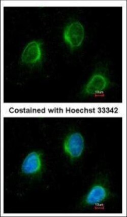 Invitrogen Calpain 3 Polyclonal Antibody 100 &mu;L; Unconjugated:Antibodies,