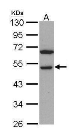 Invitrogen RCC1 Polyclonal Antibody 100 &mu;L; Unconjugated:Antibodies,