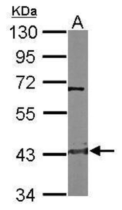 Invitrogen CTH Polyclonal Antibody 100 &mu;L | Buy Online | Invitrogen&trade; | Fisher Scientific