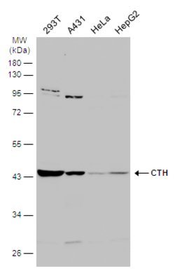 Invitrogen CTH Polyclonal Antibody 100 &mu;L | Buy Online | Invitrogen&trade; | Fisher Scientific