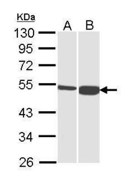 Invitrogen DBT Polyclonal Antibody 100 &mu;L; Unconjugated:Antikörper