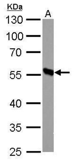 Invitrogen DBT Polyclonal Antibody 100 &mu;L; Unconjugated:Antikörper