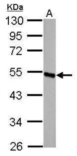 Invitrogen DBT Polyclonal Antibody 100 &mu;L; Unconjugated:Antikörper