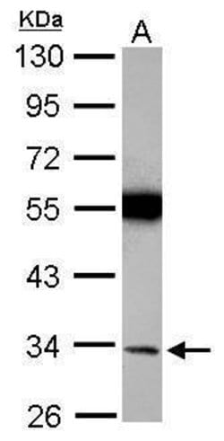 Torsin 1A Polyclonal Antibody:Antibodies, Polyclonal