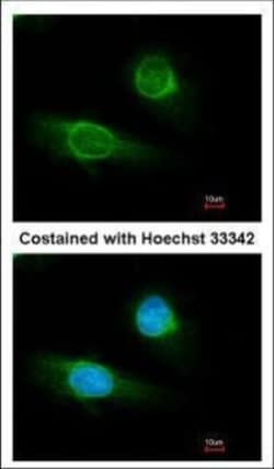 Invitrogen Fibrinogen gamma Polyclonal Antibody 100 &mu;L; Unconjugated:Antibodies,