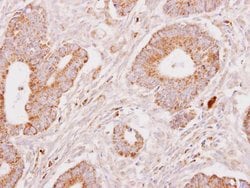 Invitrogen Fibrinogen gamma Polyclonal Antibody 100 &mu;L; Unconjugated:Antibodies,