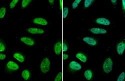 Invitrogen GATA2 Polyclonal Antibody 100 &mu;L; Unconjugated:Antibodies,