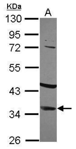 Invitrogen IGFBP2 Polyclonal Antibody 100 &mu;L; Unconjugated:Antibodies,