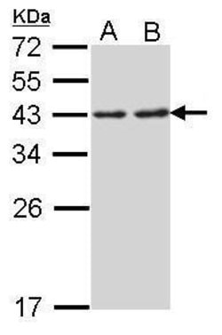 Invitrogen RPSA Polyclonal Antibody 100 &mu;L; Unconjugated:Antibodies,