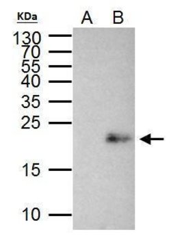 Invitrogen MAX Polyclonal Antibody 100 &mu;L | Buy Online | Invitrogen&trade; | Fisher Scientific