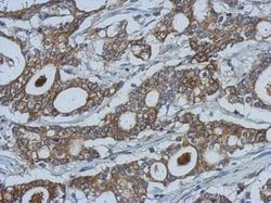 Invitrogen MMP10 Polyclonal Antibody 100 &mu;L; Unconjugated:Antibodies,