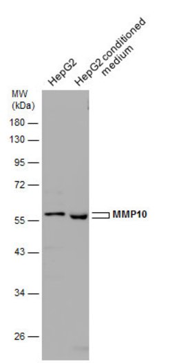 Invitrogen MMP10 Polyclonal Antibody 100 &mu;L; Unconjugated:Antibodies,