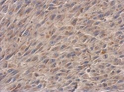 Invitrogen NDUFS3 Polyclonal Antibody 100 &mu;L; Unconjugated:Antibodies,
