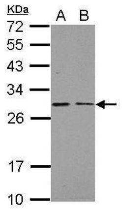 Invitrogen NDUFS3 Polyclonal Antibody 100 &mu;L; Unconjugated:Antibodies,