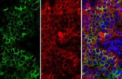 CD73 Polyclonal Antibody:Antibodies, Polyclonal