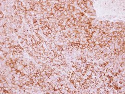 CD73 Polyclonal Antibody:Antibodies, Polyclonal