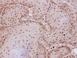 Invitrogen PP2A alpha Polyclonal Antibody 100 &mu;L; Unconjugated:Antibodies,