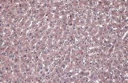 Invitrogen PP2A alpha Polyclonal Antibody 100 &mu;L; Unconjugated:Antibodies,