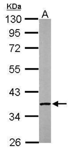 Invitrogen PP2A alpha Polyclonal Antibody 100 &mu;L; Unconjugated:Antibodies,