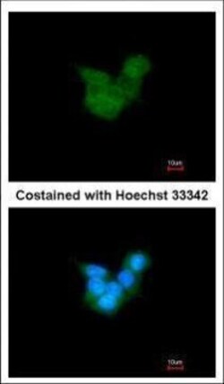 Invitrogen CRALBP Polyclonal Antibody 100 &mu;L; Unconjugated:Antibodies,