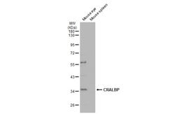 Invitrogen CRALBP Polyclonal Antibody 100 &mu;L; Unconjugated:Antibodies,