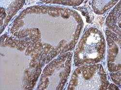 Seryl-tRNA synthetase Polyclonal Antibody:Antibodies, Polyclonal