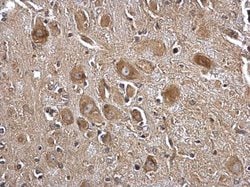 Seryl-tRNA synthetase Polyclonal Antibody:Antibodies, Polyclonal