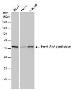 Seryl-tRNA synthetase Polyclonal Antibody:Antibodies, Polyclonal