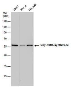 Seryl-tRNA synthetase Polyclonal Antibody, Invitrogen&trade; 100 &mu;L; Unconjugated 