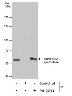 Seryl-tRNA synthetase Polyclonal Antibody, Invitrogen&trade; 100 &mu;L; Unconjugated 