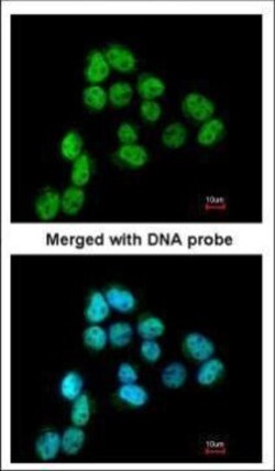Invitrogen SSB Polyclonal Antibody 100 &mu;L; Unconjugated:Antibodies,