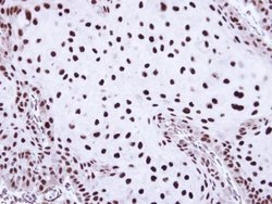 Invitrogen SSB Polyclonal Antibody 100 &mu;L; Unconjugated:Antibodies,