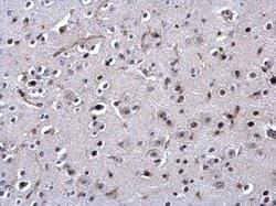 Invitrogen SSB Polyclonal Antibody 100 &mu;L; Unconjugated:Antibodies,