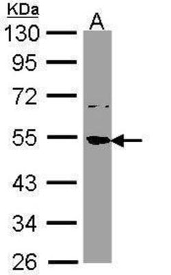 Invitrogen SSB Polyclonal Antibody 100 &mu;L; Unconjugated:Antibodies,